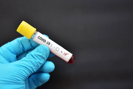 Blood sample tube positive with COVID-19 or novel coronavirus 2019の写真素材