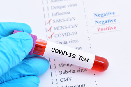Blood sample tube positive with COVID-19 virus