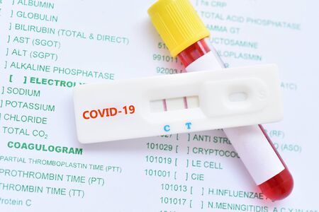 Positive test result by using rapid test device for COVID-19 virusの写真素材