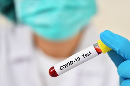 Lab technician holding blood sample tube for COVID-19 testの写真素材