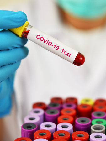 Test tube with blood sample for COVID-19 test