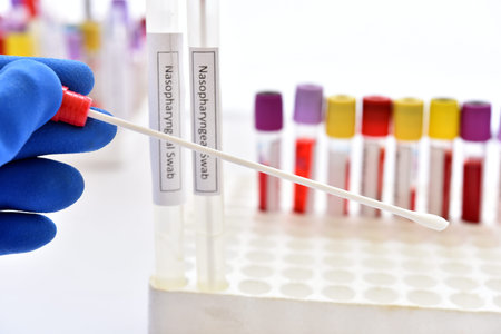 Test tube with nasopharyngeal swab from patient for COVID-19 testing by RT-PCR method