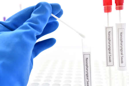 Test tube with nasopharyngeal swab from patient for COVID-19 testing by RT-PCR methodの写真素材