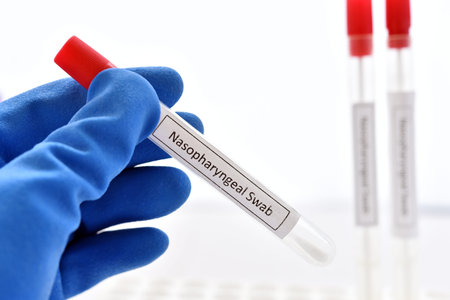 Test tube with nasopharyngeal swab from patient for COVID-19 testing by RT-PCR methodの写真素材