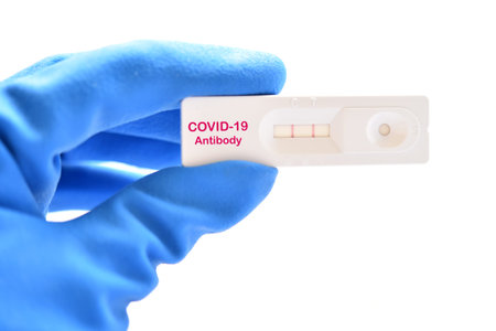 COVID-19 positive test result by using rapid card test for COVID-19 antibody