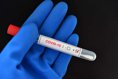 Nasopharyngeal swab positive with COVID-19 test by using RT-PCR methodの写真素材