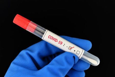 Nasopharyngeal swab negative with COVID-19 test by using RT-PCR method