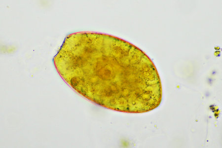 Egg of intestinal fluke in human stool, analyze by microscope, original magnification 400x
