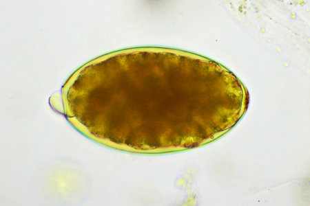 Egg of intestinal fluke in human stool, analyze by microscope, original magnification 400x
