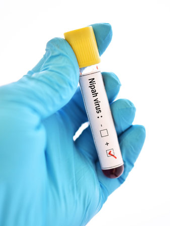 Blood sample tube positive with Nipah virus test