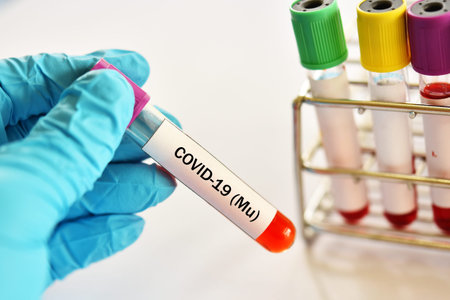 Mu variant COVID-19 positive, blood sample tube positive with mu variant of COVID-19 coronavirus