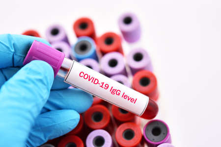 COVID-19 IgG level test, blood sample tube for COVID-19 antibody level test, after vaccinationの写真素材