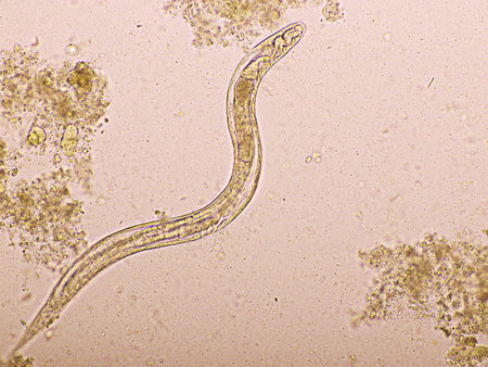 Strongyloides stercoralis or threadworm in human stool, analyze by microscope, original...