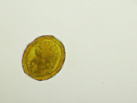 Egg of Ascaris lumbricoides (roundworm) in human stool, analyze by microscope, 400x