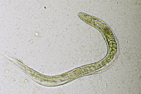 Strongyloides stercoralis or threadworm in human stool, analyze by microscope, original magnification 400xの写真素材