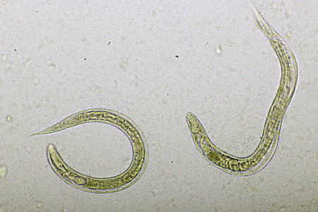 Strongyloides stercoralis or threadworm in human stool, analyze by microscope, original magnification 400xの写真素材
