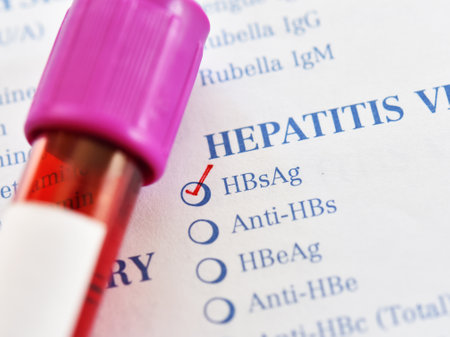 Blood sample tube with laboratory requisition form for hepatitis B virus testの写真素材
