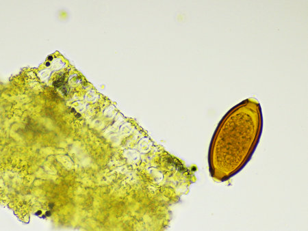 Egg of Trichuris trichiura (whipworm) in human stool, analyze by microscope, original magnification 400xの写真素材