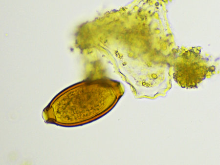 Egg of Trichuris trichiura (whipworm) in human stool, analyze by microscope, original magnification 400xの写真素材