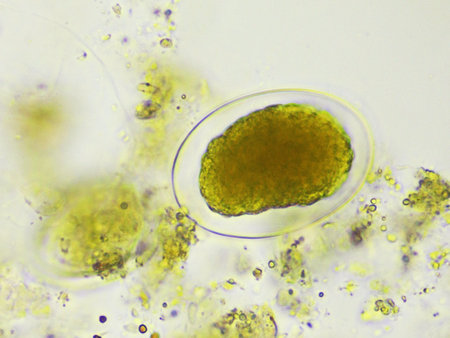 Egg of Hookworm in human stool, analyze by microscope, original magnification 400xの写真素材