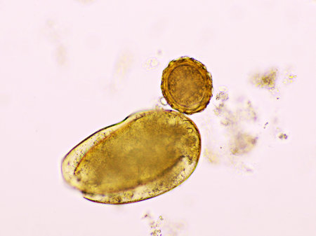 Egg of Ascaris lumbricoides (roundworm) in human stool, analyze by microscope, 400xの写真素材