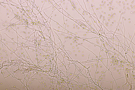 Fungus and red blood cells in hemoculture tube, analyze by microscope 400x, specimen from HIV/AIDS patientの写真素材