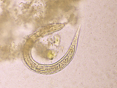 Strongyloides stercoralis or threadworm in human stool, analyze by microscope, original magnification 400xの写真素材