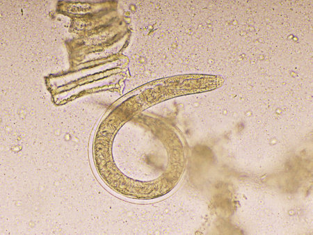 Strongyloides stercoralis or threadworm in human stool, analyze by microscope, original magnification 400xの写真素材