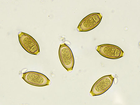 Egg of Trichuris trichiura (whipworm) in human stool, analyze by microscope, original magnification 400xの写真素材
