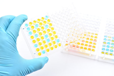 Enzyme-linked immunosorbent assay or ELISA plate, Immunology testing method in medical laboratoryの写真素材