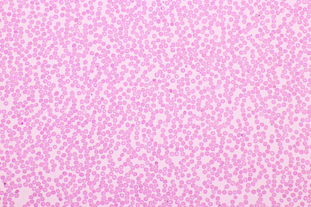 Red blood cells and white blood cells in blood smear, Wright-Giemsa stain, analyze by microscope, 10xの写真素材