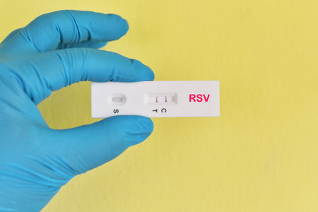 RSV positive test result by using respiratory syncytial virus (RSV) antigen test kit, rapid test methodの写真素材