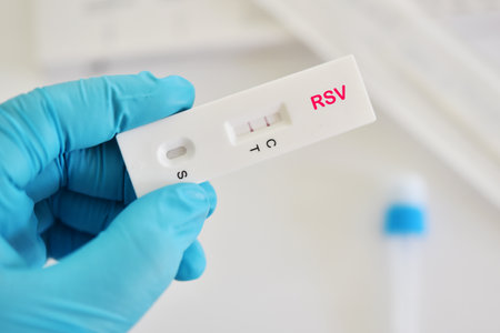 RSV positive test result by using respiratory syncytial virus (RSV) antigen test kit, rapid test methodの写真素材