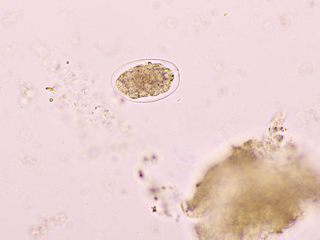 Egg of Hookworm in human stool, analyze by microscopeの写真素材