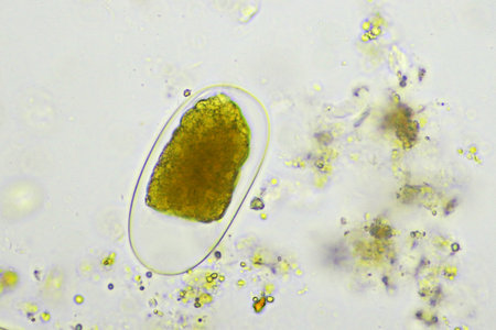 Egg of Hookworm in human stool, analyze by microscope, original magnification 400xの写真素材