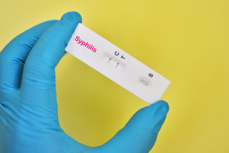 Syphilis positive test result by using rapid test deviceの写真素材