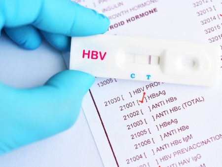 Hepatitis B virus positive test result by using rapid test deviceの写真素材