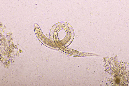 Strongyloides stercoralis or threadworm in human stoolの写真素材
