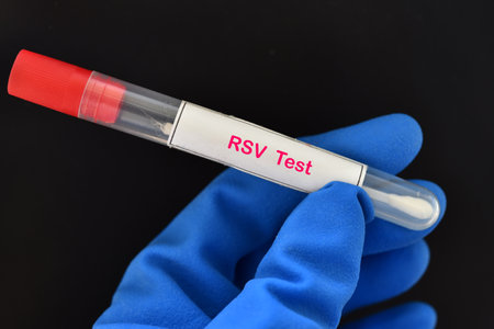 Nasopharyngeal swab from patient for respiratory syncytial virus (RSV) testの写真素材
