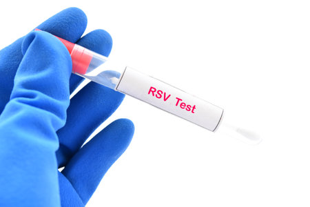 Nasopharyngeal swab from patient for respiratory syncytial virus (RSV) testの写真素材