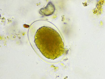 Egg of Hookworm in human stool, analyze by microscope, original magnification 400xの写真素材