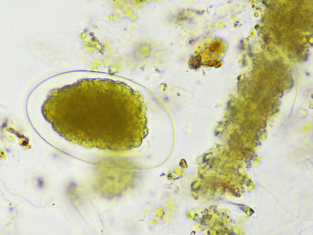 Egg of Hookworm in human stool, analyze by microscope, original magnification 400xの写真素材