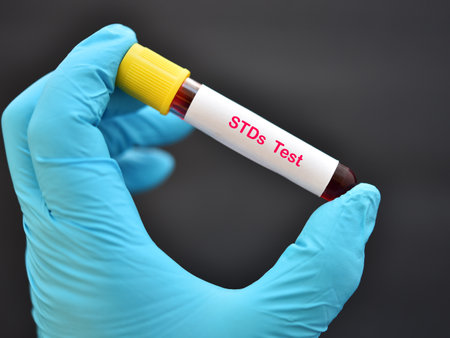 Blood sample tube for STDs (sexually transmitted diseases) testの写真素材