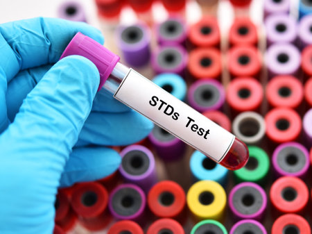 Blood sample tube for STDs (sexually transmitted diseases) testの写真素材