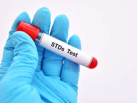Blood sample tube for STDs (sexually transmitted diseases) testの写真素材
