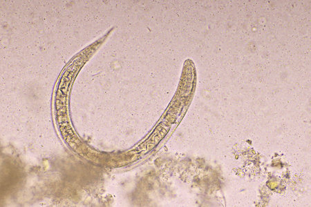 Strongyloides stercoralis or threadworm in human stoolの写真素材