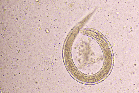 Strongyloides stercoralis or threadworm in human stoolの写真素材