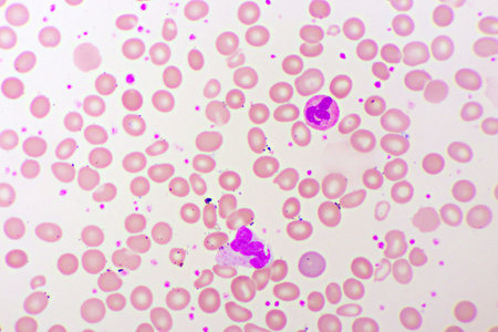 White blood cell in blood smear, analyze by microscopeの写真素材