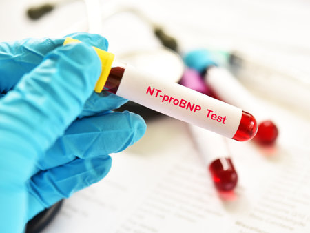 Blood sample tube for NT-proBNP testの写真素材