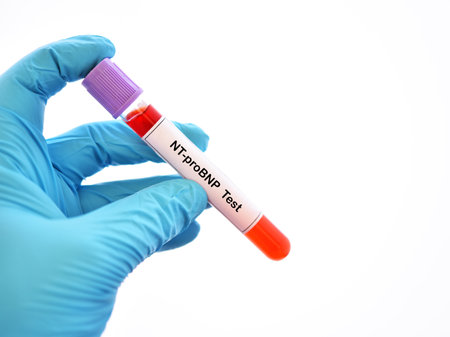 Blood sample tube for NT-proBNP testの写真素材
